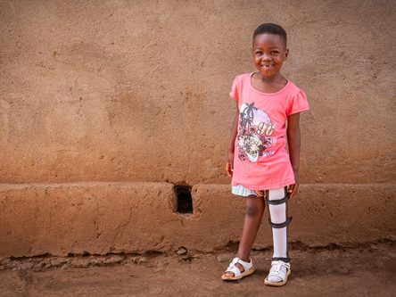 Prosthetics, Braces, Splints