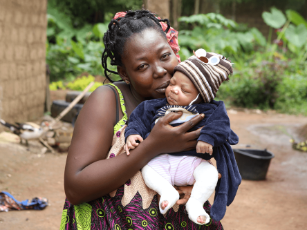 Straighten a Baby’s Clubfoot